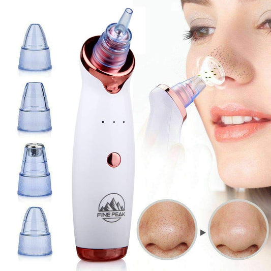 GlowSuction™ Electric Blackhead Remover
