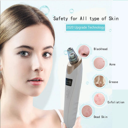 GlowSuction™ Electric Blackhead Remover